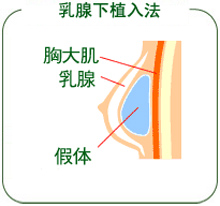 ֲ뷨